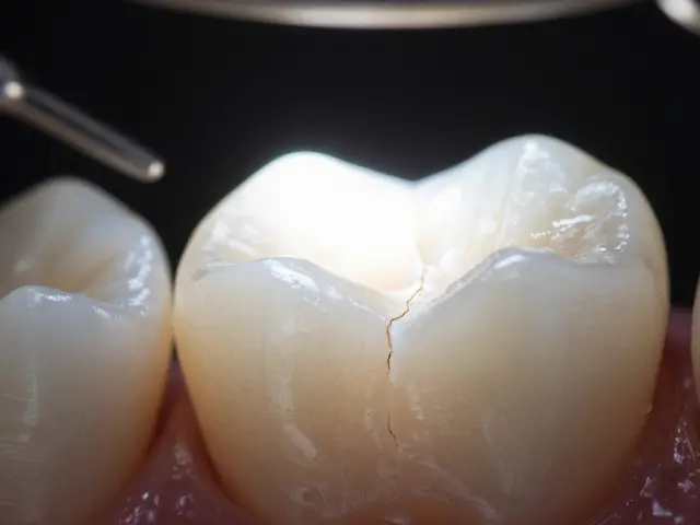 Prasklá zubní sklovina: jak ji zachránit a vyhnout se dalšímu poškození