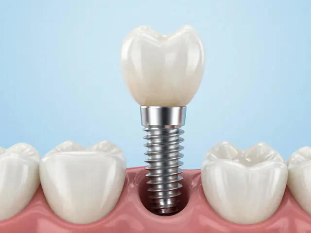 Implantát vs. můstek: Která varianta pro doplnění chybějících zubů je lepší?