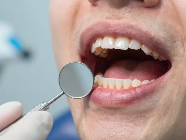 Co znamená Bílá dáseň? Původ, historie a souvislost s implantáty